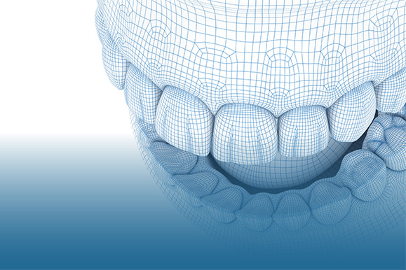 Focus Dental Bodrum CAD/CAM
