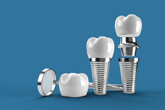 Focus Dental Bodrum Dental Implants